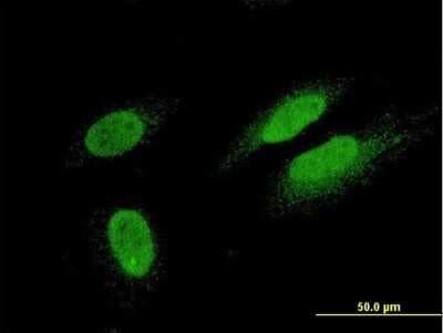 Immunocytochemistry/ Immunofluorescence: Titin Antibody (6H5) [H00007273-M09]
