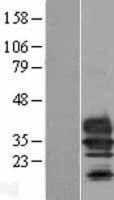Western Blot: Collectrin/TMEM27 Overexpression Lysate [NBL1-17069]
