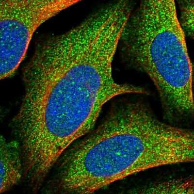 Immunocytochemistry/ Immunofluorescence: Tollip Antibody [NBP1-81597]