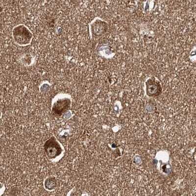 Immunohistochemistry-Paraffin: Tollip Antibody [NBP1-81597]