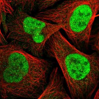 Immunocytochemistry/ Immunofluorescence: TopBP1 Antibody [NBP2-55484]