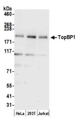 Western Blot: TopBP1 Antibody [NB100-217]