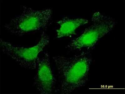 Immunocytochemistry/ Immunofluorescence: Topo III beta Antibody (1H4) [H00008940-M04]