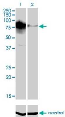 Western Blot: Topo III beta Antibody (4F11) [H00008940-M01]