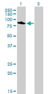 Western Blot: Topo III beta Antibody (4F11) [H00008940-M01]