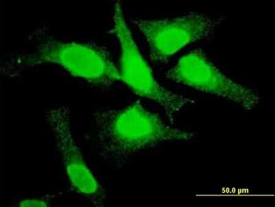 Immunocytochemistry/ Immunofluorescence: Topo III beta Antibody (4H7) [H00008940-M05]