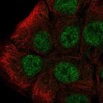 Immunocytochemistry/ Immunofluorescence: Topo III beta Antibody [NBP3-17775]