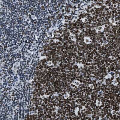 Immunohistochemistry-Paraffin: Topoisomerase I Antibody [NBP1-90365]
