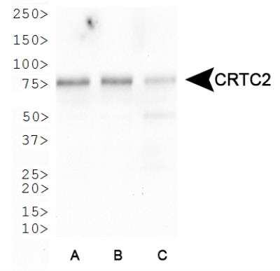 Western Blot: TORC2 AntibodyBSA Free [NBP2-22356]