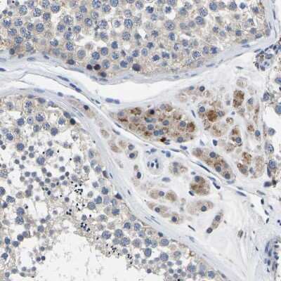Immunohistochemistry-Paraffin: Torsin 1B Antibody [NBP1-84983]