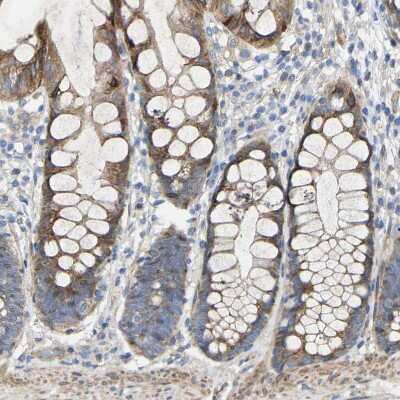 Immunohistochemistry-Paraffin: Torsin 1B Antibody [NBP1-84984]