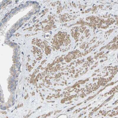 Immunohistochemistry-Paraffin: Torsin 1B Antibody [NBP1-84984]