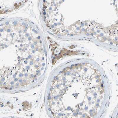 Immunohistochemistry-Paraffin: Torsin 1B Antibody [NBP1-84984]