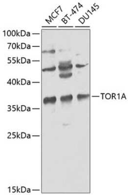 Western Blot: Torsin A AntibodyBSA Free [NBP3-03780]