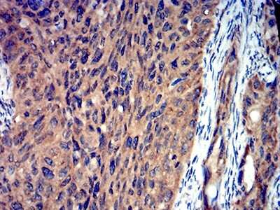 Immunohistochemistry-Paraffin: Toxoplasma gondii ROP1 Antibody (3D4B2) - BSA Free [NBP2-61906]