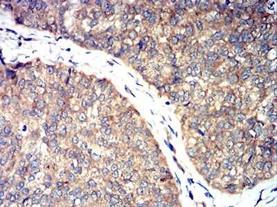 Immunohistochemistry: Toxoplasma gondii ROP1 Antibody (3D4B2) - BSA Free [NBP2-61906]