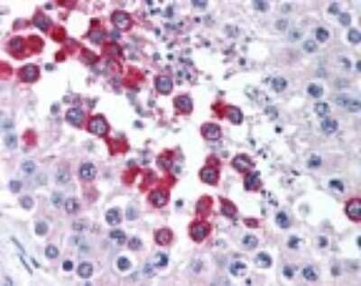 Immunohistochemistry-Paraffin: Trace Amine Receptor 1 Antibody [NBP2-24720]