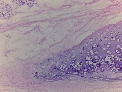Hematoxylin & Eosin Stain: Trachea Tissue Slides (Adult Normal)- Frozen [NBP2-77574]