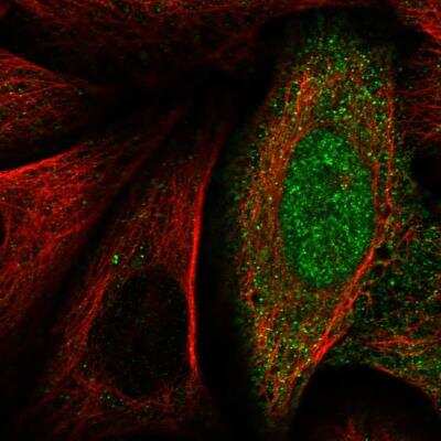 Immunocytochemistry/ Immunofluorescence: Transaldolase 1 Antibody [NBP1-88109]