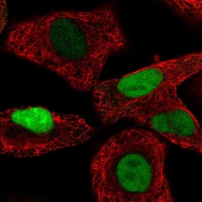 Immunocytochemistry/ Immunofluorescence: Transaldolase 1 Antibody [NBP2-56305]