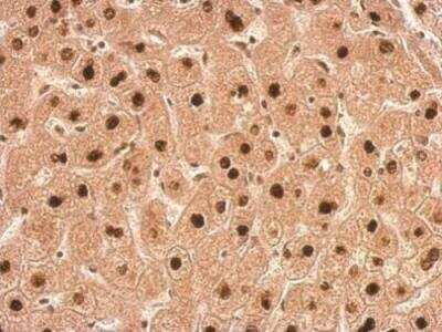 Immunohistochemistry-Paraffin: Transaldolase 1 Antibody [NBP1-32121]