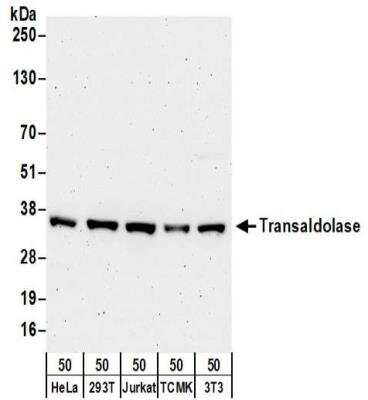 Western Blot: Transaldolase 1 Antibody [NBP2-32217]