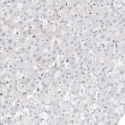 Immunohistochemistry-Paraffin: Transcription factor E3 Antibody (CL12810) [NBP3-18574]