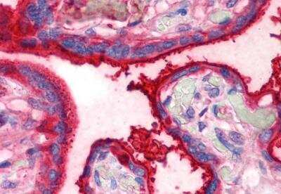 Immunohistochemistry-Paraffin: Transferrin Antibody (HTF-14) - BSA Free [NB500-418]