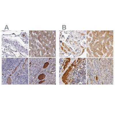 Immunohistochemistry-Paraffin: Transferrin Antibody [NBP1-87221]