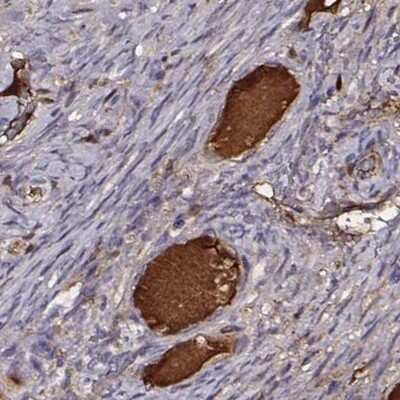 Immunohistochemistry-Paraffin: Transferrin Antibody [NBP1-87221]