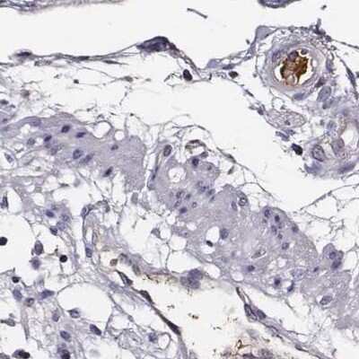 Immunohistochemistry-Paraffin: Transferrin Antibody [NBP1-87221]