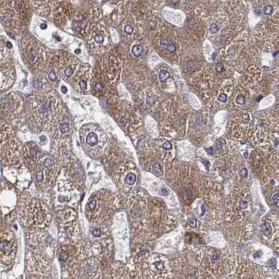Immunohistochemistry-Paraffin: Transferrin Antibody [NBP1-87221]