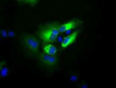 Immunocytochemistry/ Immunofluorescence: Transferrin Antibody (OTI5G2) [NBP2-02264]