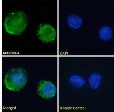 Immunocytochemistry/ Immunofluorescence: Transferrin Antibody (TW4.20) - Chimeric - Azide and BSA Free [NBP2-81094]