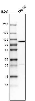 Western Blot: Transferrin Antibody [NBP1-87221]