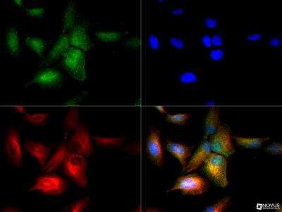 Immunocytochemistry/ Immunofluorescence: TfR (Transferrin R) Antibody - BSA Free [NB100-92243]