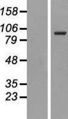 Western Blot: TfR (Transferrin R) Overexpression Lysate [NBP2-09467]