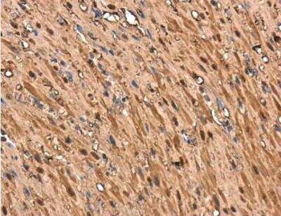 Immunohistochemistry-Paraffin: Transgelin/TAGLN/SM22 alpha Antibody [NBP1-33003]