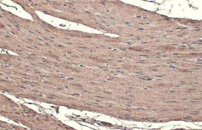 Immunohistochemistry-Paraffin: Transgelin/TAGLN/SM22 alpha Antibody [NBP1-33003]