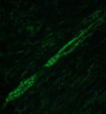 Immunohistochemistry-Paraffin: Transgelin/TAGLN/SM22 alpha Antibody [NBP2-20405]