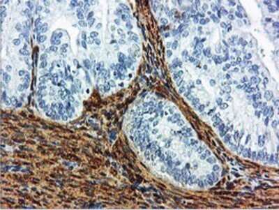 Immunohistochemistry: Transgelin/TAGLN/SM22 alpha Antibody (OTI8C8) - Azide and BSA Free [NBP2-74584]