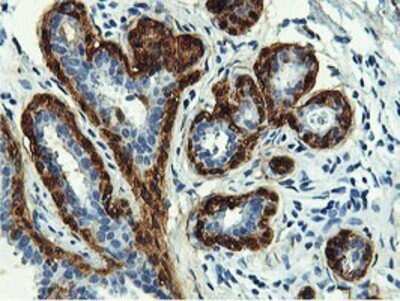 Immunohistochemistry: Transgelin/TAGLN/SM22 alpha Antibody (OTI8C8) - Azide and BSA Free [NBP2-74584]