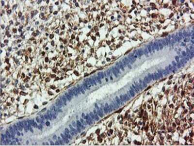 Immunohistochemistry: Transgelin/TAGLN/SM22 alpha Antibody (OTI8C8) - Azide and BSA Free [NBP2-74584]