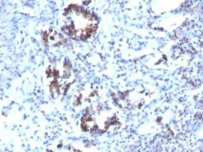 Immunohistochemistry-Paraffin: Transgelin/TAGLN/SM22 alpha Antibody (SPM606) - IHC-Prediluted [NBP2-48074]