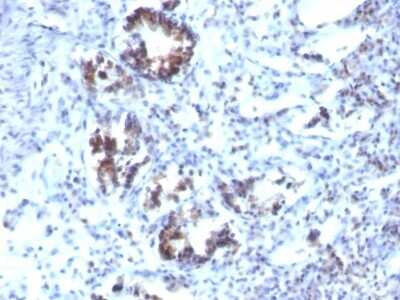 Immunohistochemistry-Paraffin: Transgelin/TAGLN/SM22 alpha Antibody (SPM606) [NBP2-44436]