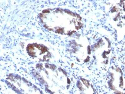 Immunohistochemistry-Paraffin: Transgelin/TAGLN/SM22 alpha Antibody (TAGLN/247) [NBP2-44435]