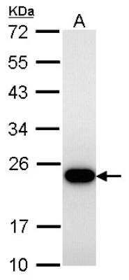 Western Blot: Transgelin/TAGLN/SM22 alpha Antibody [NBP1-33003]