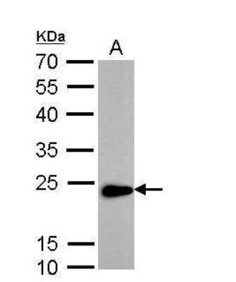 Western Blot: Transgelin/TAGLN/SM22 alpha Antibody [NBP1-33003]