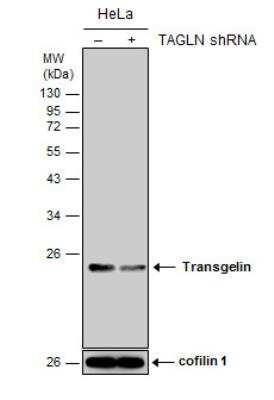 Western Blot: Transgelin/TAGLN/SM22 alpha Antibody [NBP1-33003]
