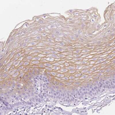 Immunohistochemistry-Paraffin: Transglutaminase 1/TGM1 Antibody [NBP2-34062]